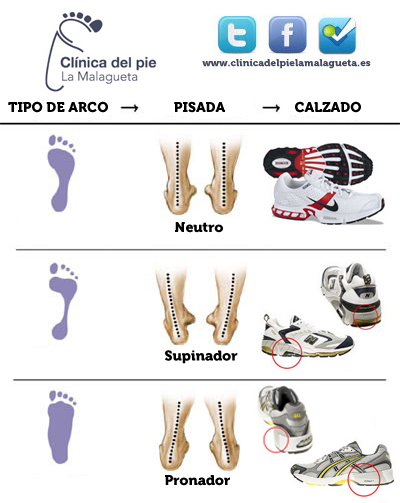 analisis de la pisada en malaga tipos de pisadas_ podologo malaga